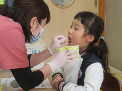 歯科衛生士さんから染め出し液を塗ってもらいました